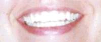 profident