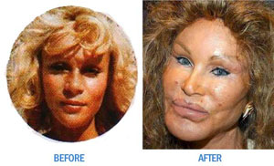 surgery1.jpg