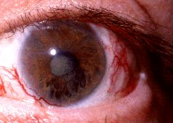 ojo