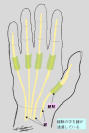 tendinitis1.jpg