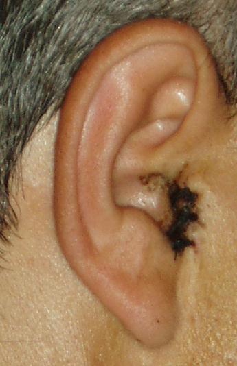 oreja.JPG