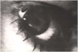 ojo01.jpg